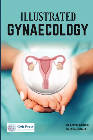 ILLUSTRATED GYNAECOLOGY