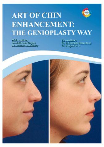 Art of Chin Enhancement:  The Genioplasty Way