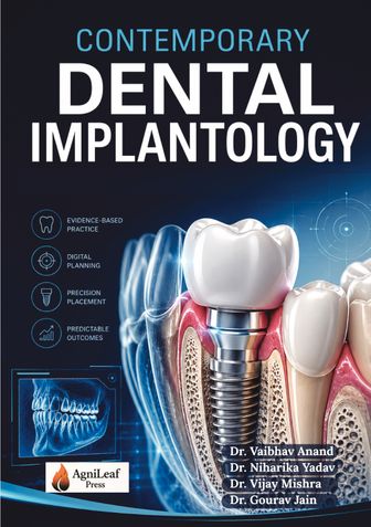 Contemporary Dental Implantology