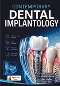 Contemporary Dental Implantology
