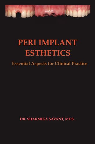 PERI IMPLANT ESTHETICS