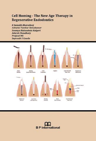 Cell Homing - The New Age Therapy in Regenerative Endodontics