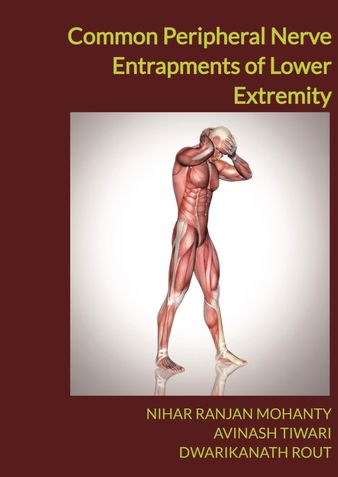 Common Peripheral Nerve Entrapments of Lower Extremity