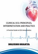 CLINICAL ECG: PRINCIPLES, INTERPRETATION AND PRACTICE