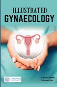 ILLUSTRATED GYNAECOLOGY